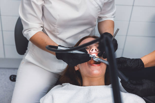 Best Knocked-Out Tooth (Avulsed Tooth) Treatment in Hanahan, SC
