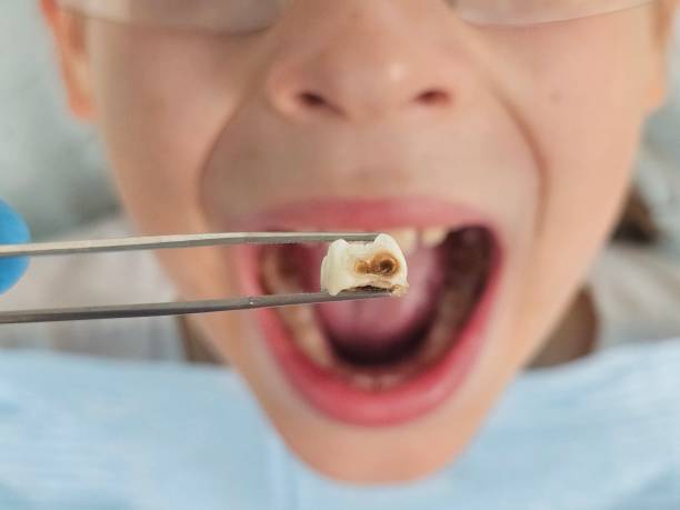 Best Walk-In Emergency Dental Services in Hanahan, SC