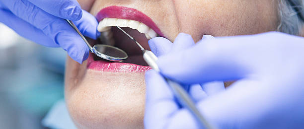 Best Emergency Dental Care for Sports Injuries in Hanahan, SC